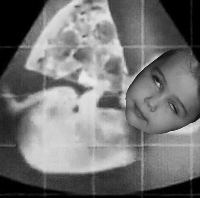 miley-fotomontaje-feto.jpg