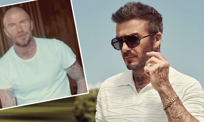 david-beckham-calvicie-770.jpg