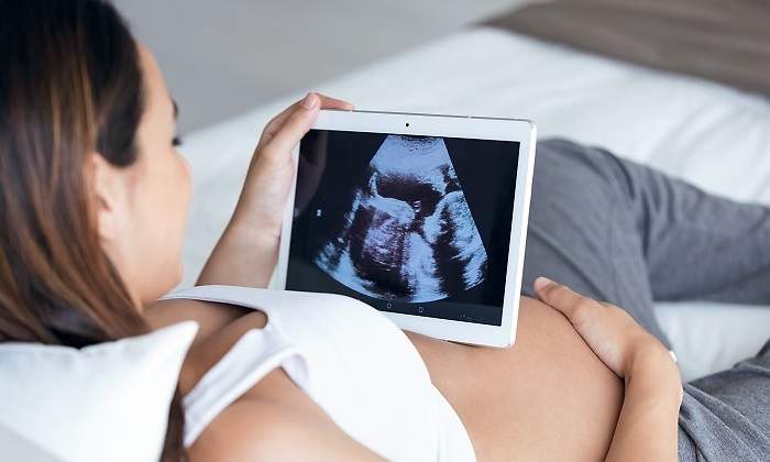 Embarazada-mirando-ecografia-iStock.jpg