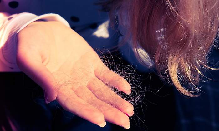 caida-pelo-diabetes-770.jpg