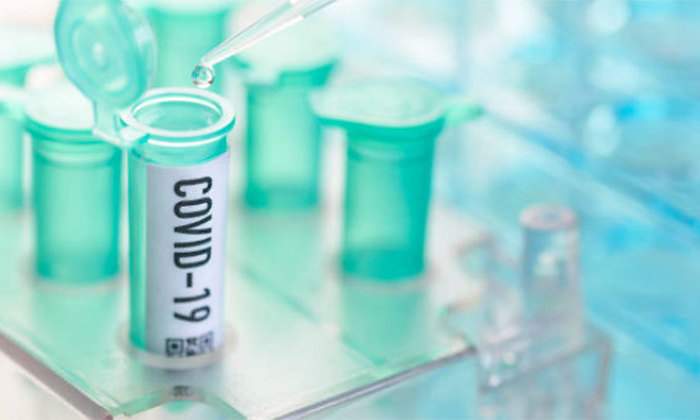 coronavirus-covid-19.jpg