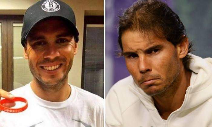 nadal-injertos770.jpg