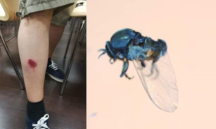 mosca-negra-picadura-insecto-ep.jpg