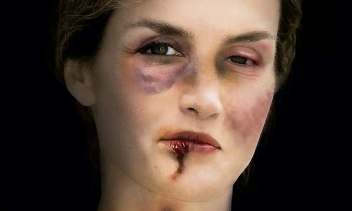 letizia-exposicion-maltrato-770.jpg