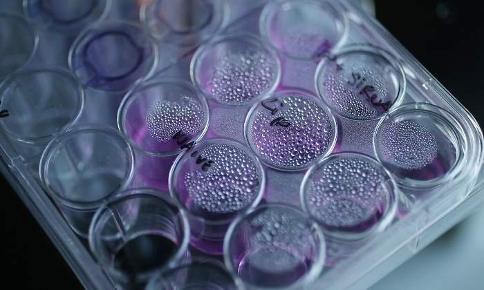 celulas-cancer-reuters.jpg