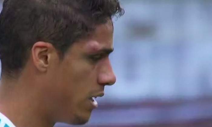 varane-chichon.jpg