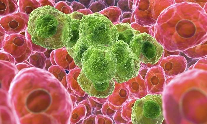 cancer-celulas-dreamstime.jpg