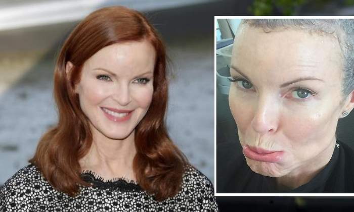 marcia-cross-cancer770.jpg