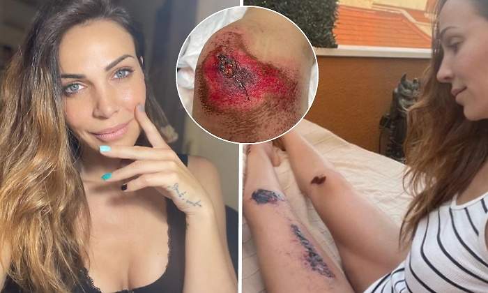 nerea-garmendia-accidente-770.jpg