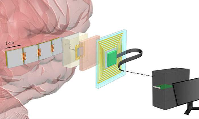 chip-neuronal.jpg