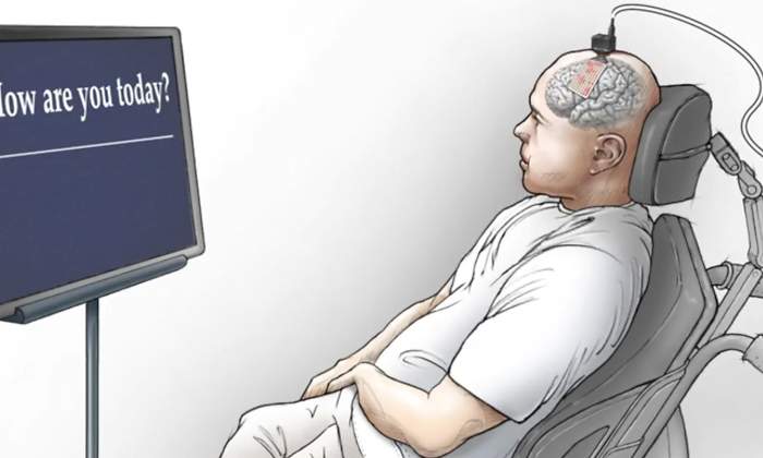 implante-cerebral.jpg