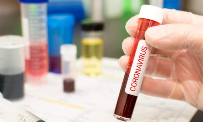 coronavirus-prueba-sangre-770.jpg