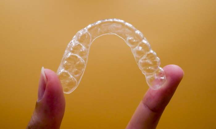 invisalign-770.jpg