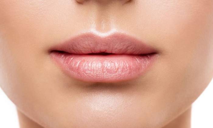 labios-arrugas-770.jpg