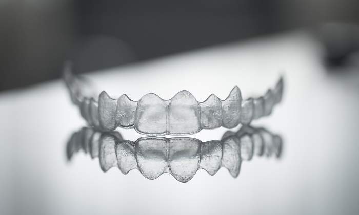invisalign-dentadura-invisible-dreamstime-770x420.jpg