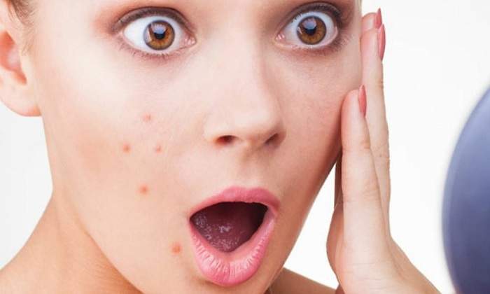 pimples-of-face-1.jpg