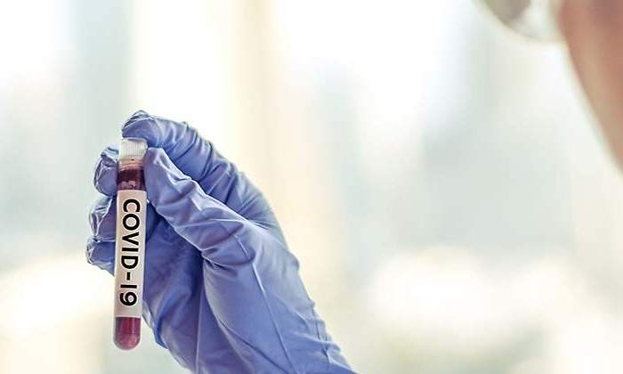 Coronavirus_probeta_Istock.jpg