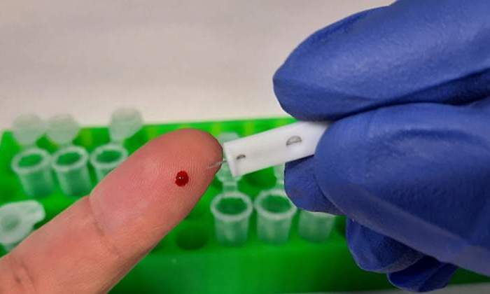 test-anticuerpos-csic.jpg