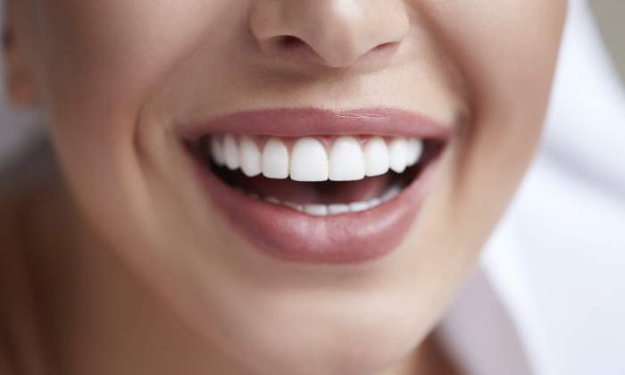 sonrisa-770.jpg