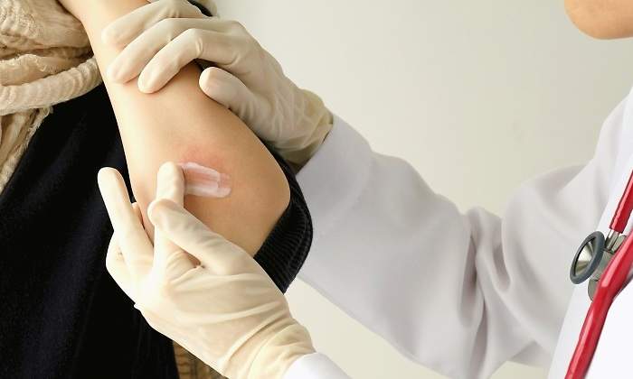 dermatitis-doctor-dreams.jpg