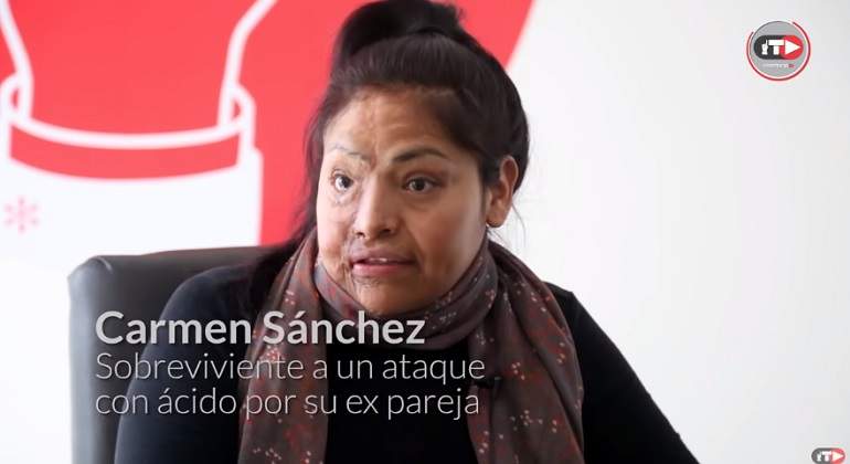 Que hacer en caso de quemadura con acido