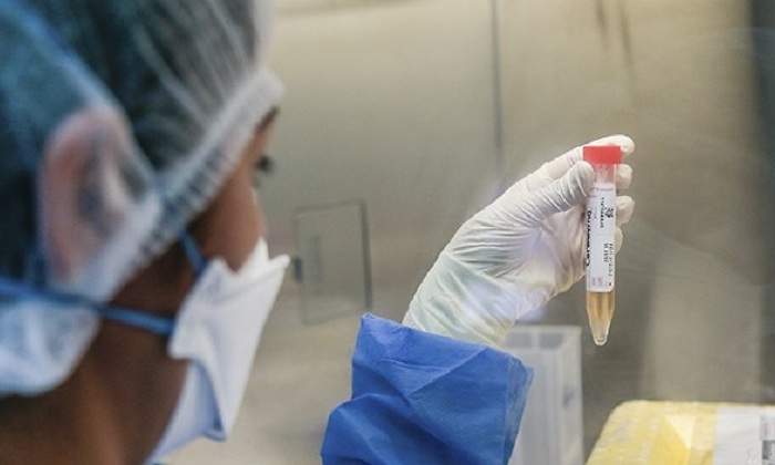 prueba-molecular.jpg