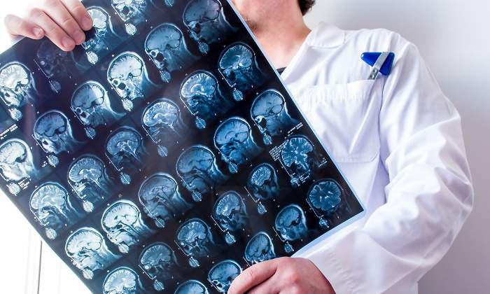 sintomas-neurologicos-covid-19.jpg