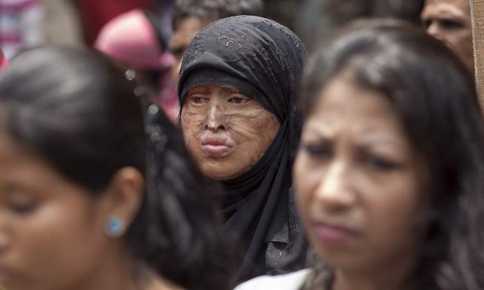 india-mujer-acido-getty.jpg
