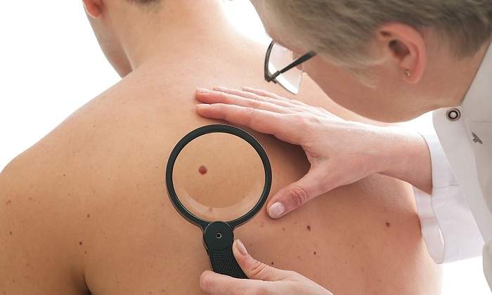 Dermatologa-mirando-un-lunar-iStock.jpg