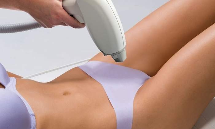 depilacion-laser.jpg