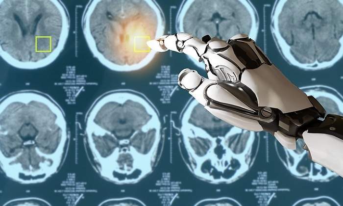 inteligencia-artificial-cancer.jpg