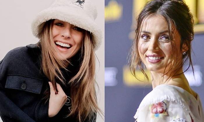carillas-dentales.jpg