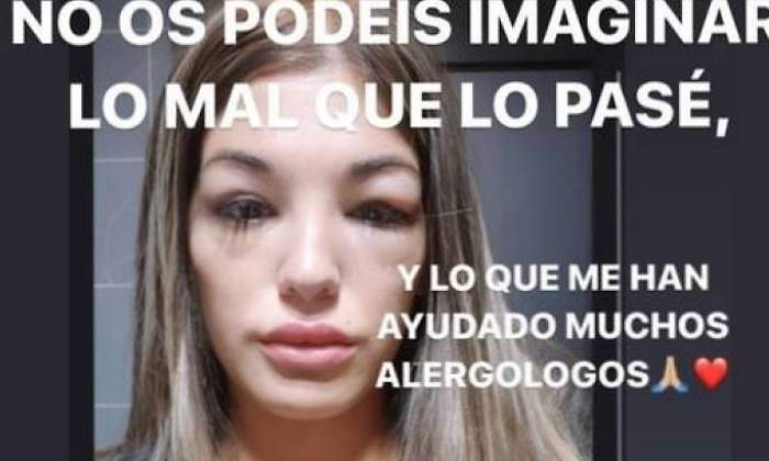 nuria-martinez-melocoton-reaccion.jpg