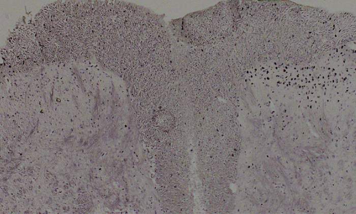 medula-espinar-celulas-quemaduras.jpg
