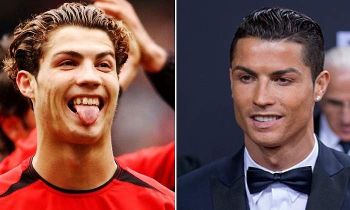cristiano-ronaldo-operaciones-770.jpg