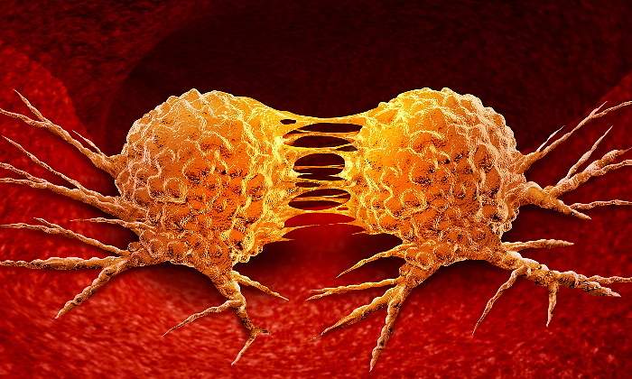 metastasis.jpg
