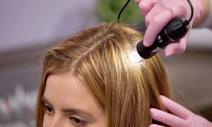 alopecia-capilar-femenina-770.jpg