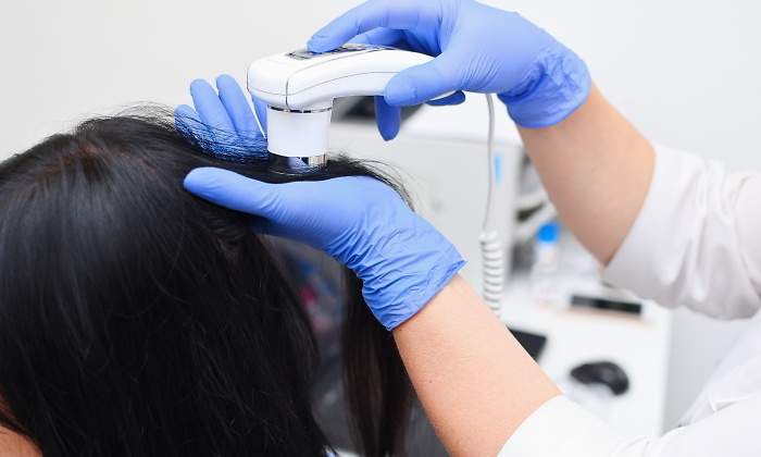 alopecia-femenina-dreamstime.jpg