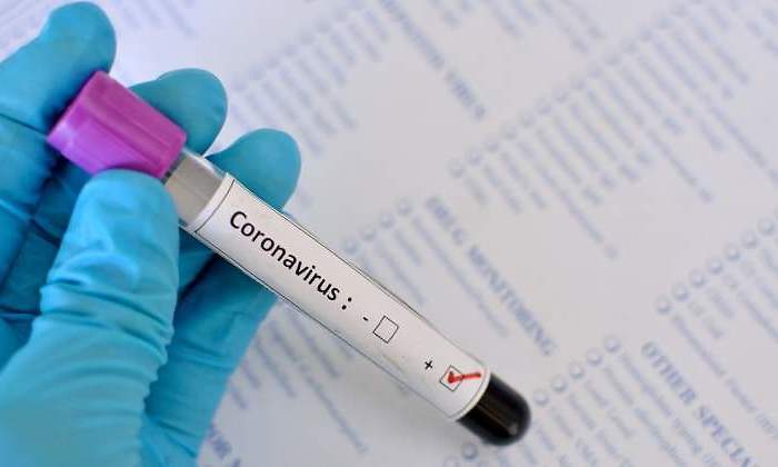 coronavirus-test-escrito-tubo-positivo-770-dreamstime.jpg