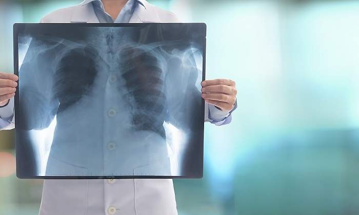 Mujer-con-radiografia-iStock.jpg