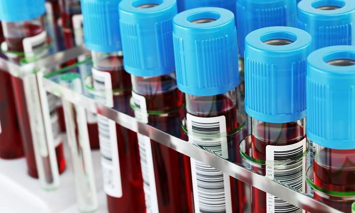 analisis-sangre-istock.jpg