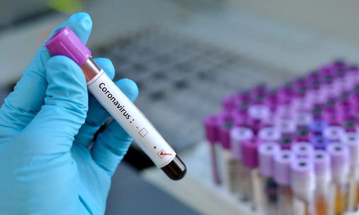 coronavirus-prueba-tubo-ensayo-positivo-770-dreamstime.jpg