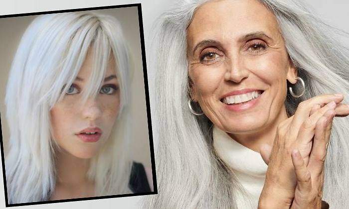 pelo-blanco770.jpg