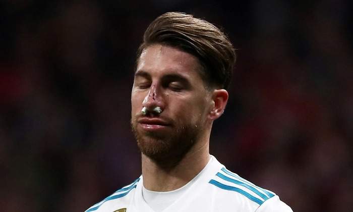 Sergio-Ramos-nariz-rota-2017-reuters.jpg