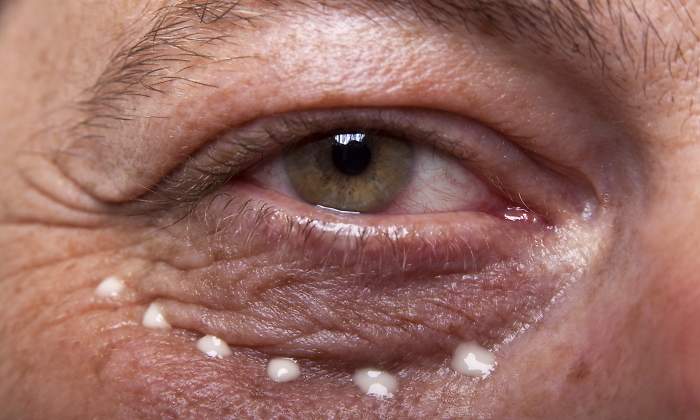 ojo-arrugas-crema-botox-dreamstime.jpg