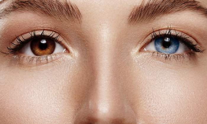ojos-dos-colores-heterocromia-dreams.jpg