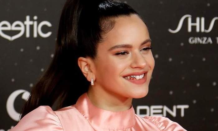 rosalia-dientes-oro-770.jpg