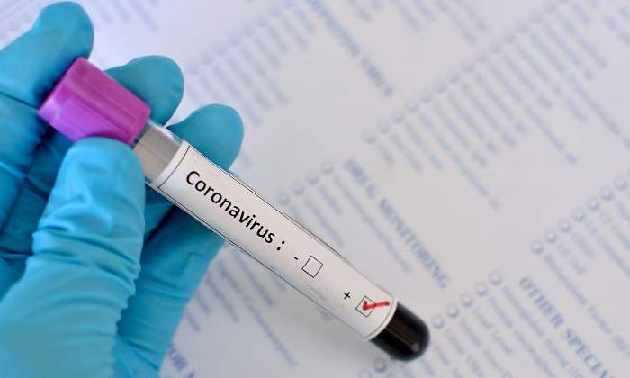 coronavirus-test-escrito-tubo-positivo-770-dreamstime.jpg