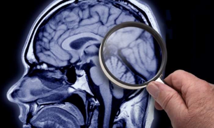 lupa-cerebro-getty.jpg