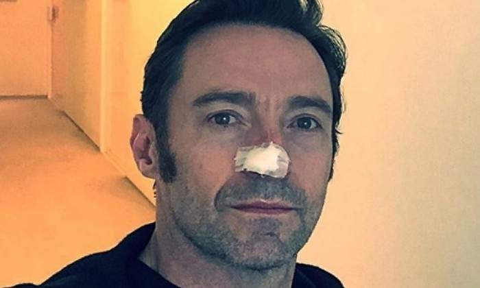 jackman-cancer770.jpg